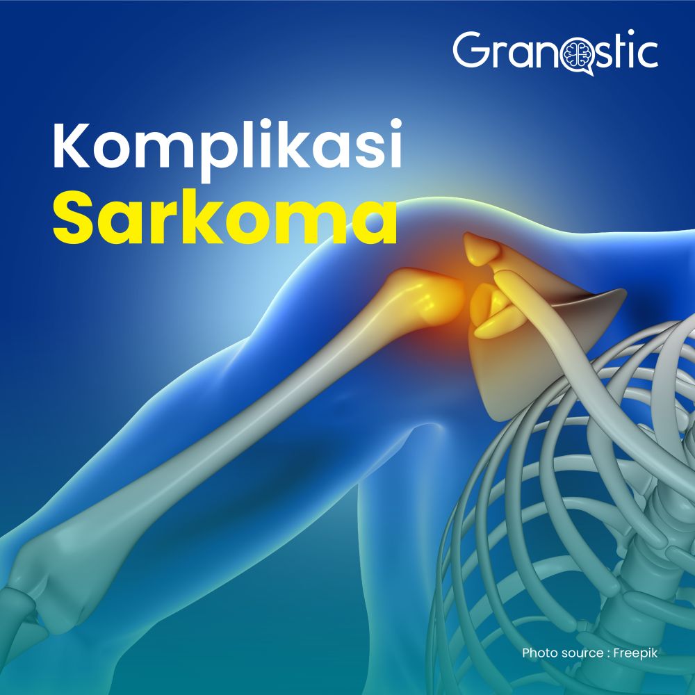 Kenali Beberapa Komplikasi Sarcoma