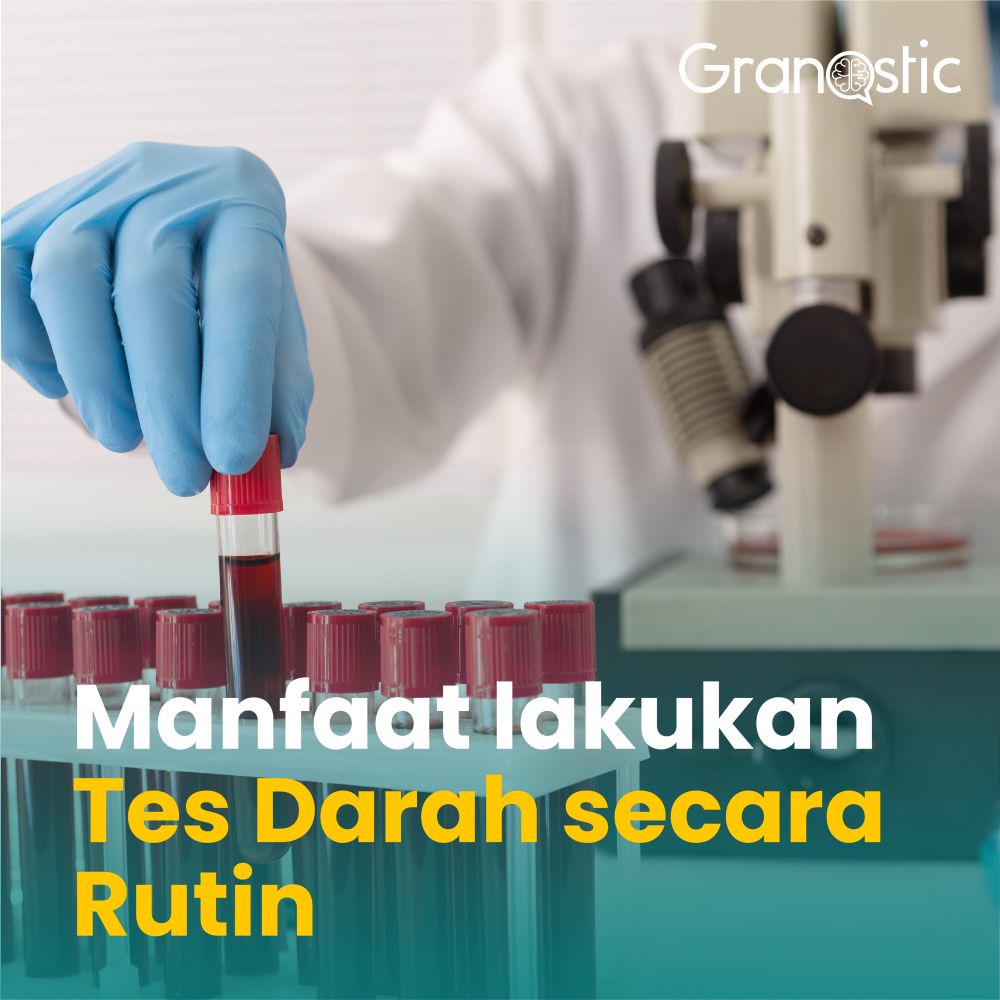 Ketahui Manfaat Dari Melakukan Tes Darah Secara Rutin
