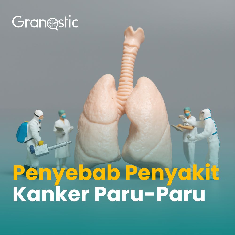 Penyebab Penyakit Kanker Paru 