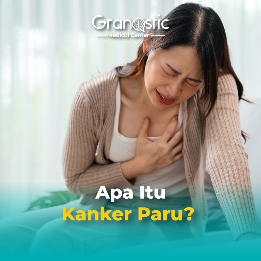 Apa Itu Kanker Paru? Berikut Penjelasannya