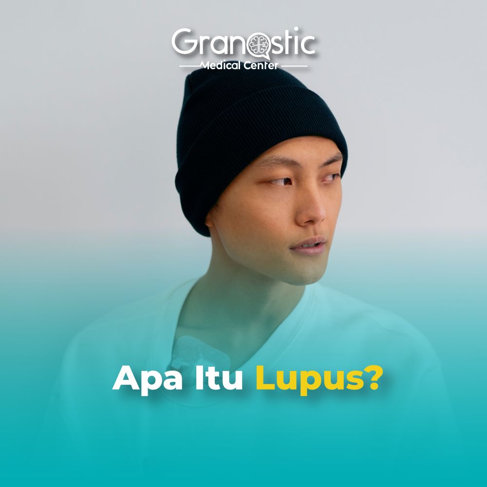 Apa Itu Lupus? Berikut Penjelasan dan Tantangan Diagnosisnya