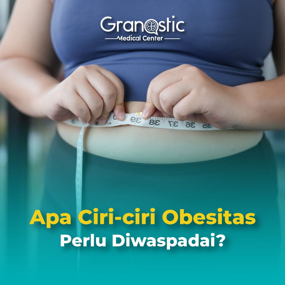 Apa Ciri-Ciri Obesitasi Perlu Diwaspadai?