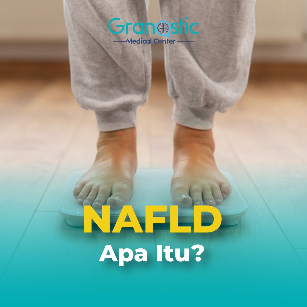nafdl apa itu?