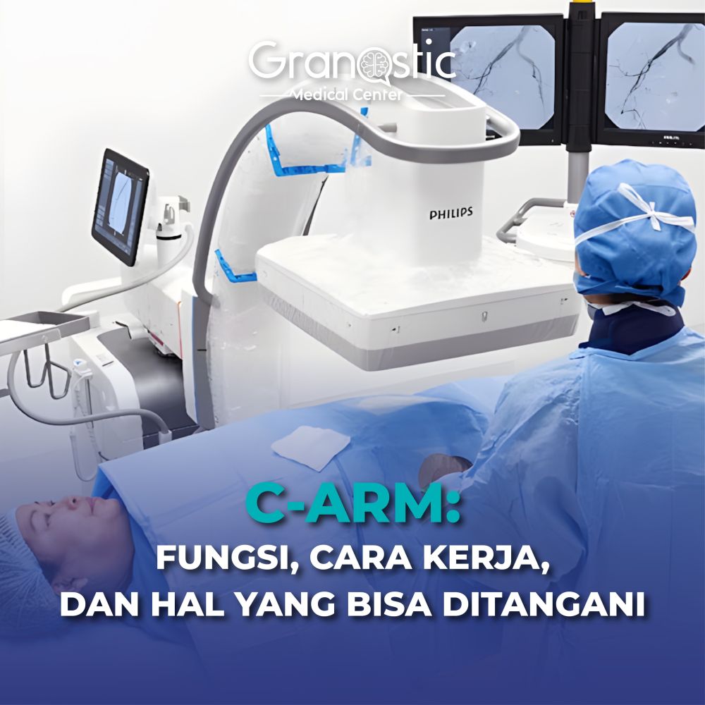 C-Arm: Fungsi, Cara Kerja, dan Hal yang Bisa Ditangani